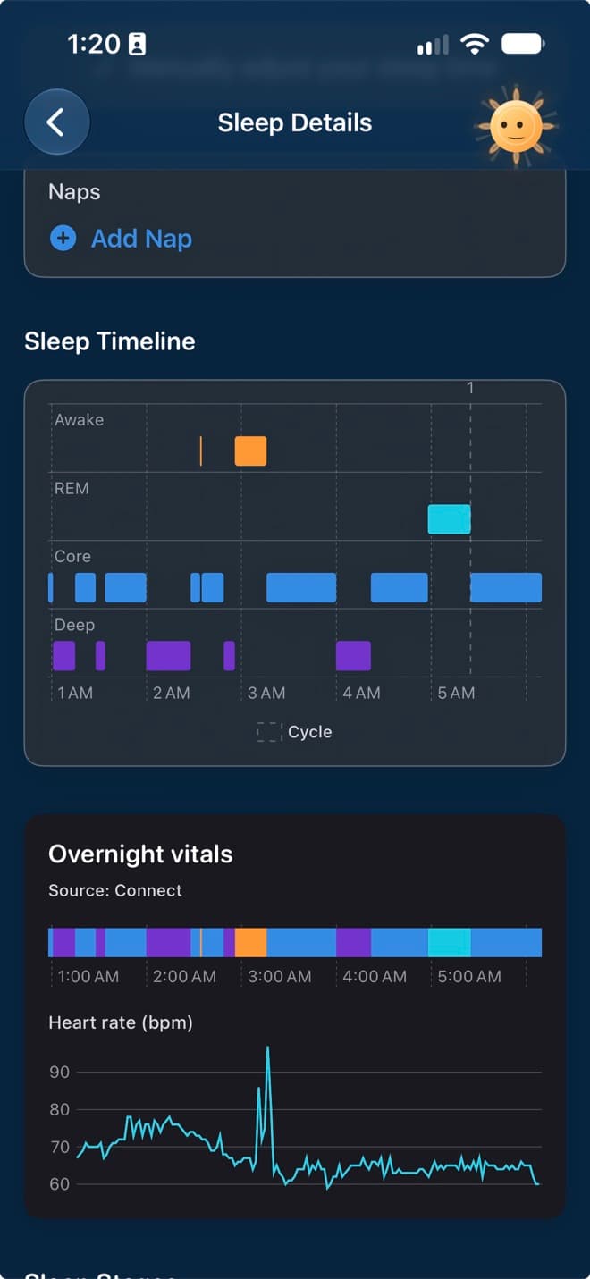 Diorama Sleep Details showing awake, REM, core, and deep sleep stages above an overnight heart-rate chart